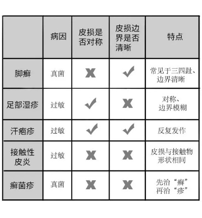 脚上怎样分辨是湿疹还是脚气（脚上怎么分辨是湿疹还是疱疹）